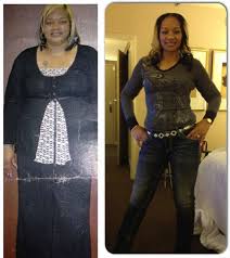 After about eight weeks on the gastric bypass diet, you can gradually return to eating firmer foods. Kenya Lost 130 Pounds With Weight Loss Surgery Black Weight Loss Success