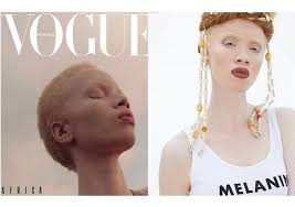 Bazen yüzü, kirpikleri, saçları tamamı ile bembeyaz olan kişiler görmekteyiz. Vogue Portugal Puts First Albino Model On Cover Global Cosmetics News