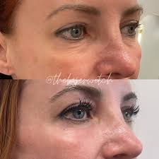 It's been awhile since I've said hi 🤍 . . I'm Kira- Laser specialist •  Skin health educator • Your neighborhood skin alchemist 🔮✨ My passion is  helping you feel confident in