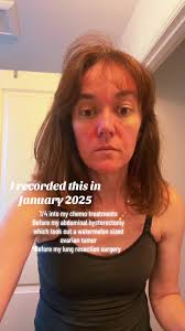 Tap Cancer Out Tournament 2025