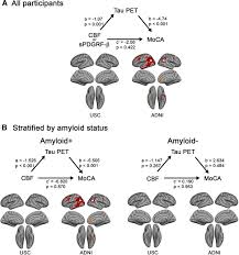 128 kbps ano de lançamento: Associations Between Vascular Function And Tau Pet Are Associated With Global Cognition And Amyloid Journal Of Neuroscience