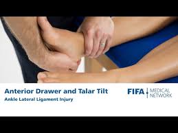 Image result for Talar Tilt
