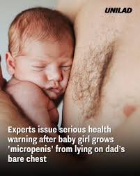 WTF?!?! 😳😳😳😳😳When cuddling has gone wrong!! #emmkaysmyth  https://www.unilad.com/news/health/experts-warning-baby-girl-micropenis-testosterone-234655-20250713?fbclid=IwQ0xDSwLg1thleHRuA2FlbQIxMQABHiSf3g8j1ydm1Nlrq00Fk-XAHHDSUKhBQz3wCsAyQv  ...