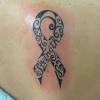 The number of skin cancers arising in tattoos is seemingly low, and this association has to be considered thus far as coincidental, they concluded. 1