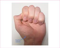 Image result for Normal Anatomic Position of the Hand and Wrist