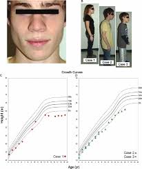 Clinical presentation of the syndromic features in affected family...