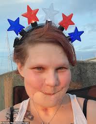 EXCLUSIVE: I shot myself in the face TWICE and miraculously survived... I  will forever regret it but now I'm using my pain to bring hope to others