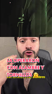 ¿Por qué los médicos la operaron con “alambres retorcidos” y tornillos en  el IMSS? Reacción a reportaje @Latinus @Latinus Podcast