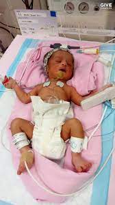 Our expert explains how long you're likely to stay in hospital after having a baby. Give Asia Baby Kirsten Was Born Prematurely At 35 Weeks Facebook