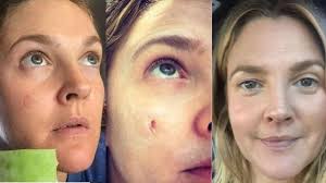 Want to use aloe vera for more than sunburn relief? Celebrities Worship Aloe And You Atlantia