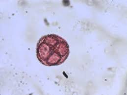 Image result for Eriocoelum