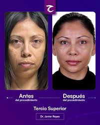 ✨ Dra. Maite Prada: Compromiso con la Educación y la Innovación Médica ✨ La  Dra. Prada se dedica a formar y certificar a médicos en la técnica avanzada  de las mallas de