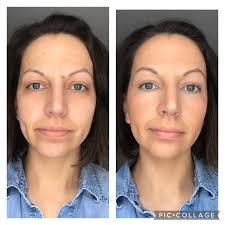 Took everyone advice yesterday hows this before and after