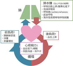 心不全 前 負荷 後 負荷