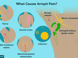 What causes swollen lymph nodes? Armpit Pain Causes Treatment When To See A Doctor