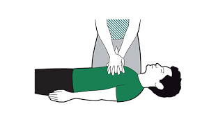 Cardiac arrest means that the heart is no longer pumping blood around the body. Cardiac Arrest Symptoms First Aid Advice St John Ambulance