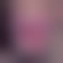 Image result for balanoposthitis