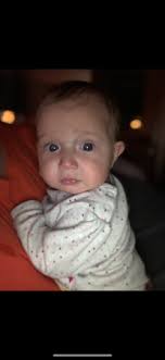 Blue Vein Between Eyes Babycenter