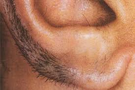 Image result for à¤à¤¾à¤¨ à¤ªà¤° à¤¦à¤¿à¤à¤¾à¤ à¤¦à¥à¤¨à¥ à¤²à¤à¥ à¤¬à¤¾à¤²