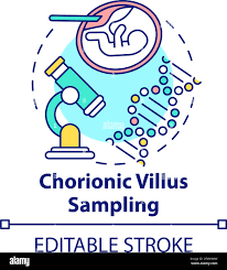 Image result for Chorionic Villus Sampling