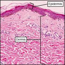 Reticular layer of dermis the deeper reticular dermis, which accounts for about 80% of the thickness of the dermis, is dense irregular connective tissue. Anatomy A215 Virtual Microscopy