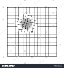 the amsler grid images stock photos vectors shutterstock