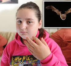 Image result for Bat Bite