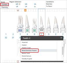 Image result for Dentition