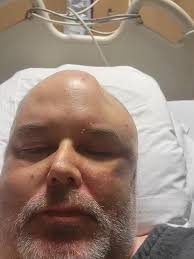 Look how it changed shape between Friday and today!!!