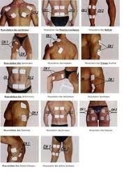 Compex edge muscle stimulator kit for pain treatment, back pain, rehabilitation, muscle growth & strength — best professional this is the most expensive gadget of our review; 17 Best Compex Muscle Stimulator Ideas Massage Therapy Tens Unit Placement Ten Unit