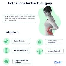 Image result for Low Back Pain Management