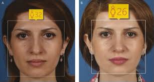 We bring you the same digital imaging technology that surgeons use to visualize plastic surgery results — all in a super easy to use app! A Way To Look Younger Is Right Under Your Nose Study Finds