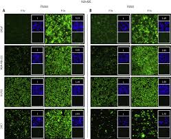 Case 986 visited the childcare centre on. Tumor Cells Surviving Exposure To Proton Or Photon Radiation Share A Common Immunogenic Modulation Signature Rendering Them More Sensitive To T Cell Mediated Killing International Journal Of Radiation Oncology Biology Physics