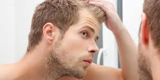 But here's the strange part: 7 Most Common Causes Of Men S Hair Loss