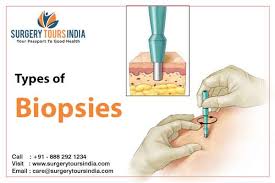 A tissue sample can be taken from almost anywhere on or in your body, including the skin, organs and other structures. Different Types Of Biopsies What Is Biopsy