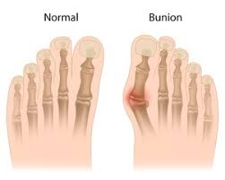 It might feel a bit tingly as this happens, like pins and needles or even a bit painful. Diabetes Related Foot And Ankle Problems