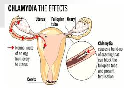 We did not find results for: Nursing Care Of The Client Sexually Transmitted Diseases