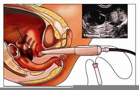 June 2013 Blog Fertiliti Dr Natasha Nor