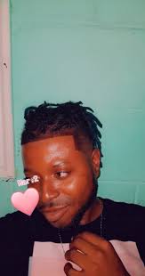 It's better to have a seasaw hair line than a ball head looking like a  fresh shave vagina🚶‍♂️