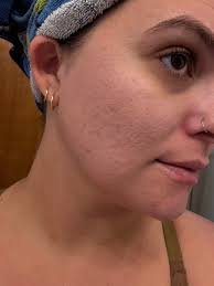 What are some good aestheticians or facialists in San Diego for pore help  and anti-aging?