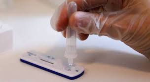 Las primeras pruebas de autodiagnóstico rápido ya están en farmacias. Covid 19 Teste Rapido De Antigeno E Promissor Mas Exige Cautela Noticias R7 Saude