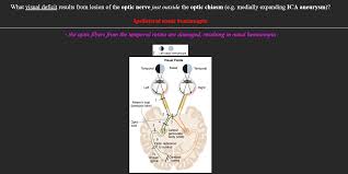 Daftar kunci jawaban bot ica ica family 100 line 2021. Zanki Card Doesn T It Make More Sense To Specify What Visual Deficit Results From Lesion Of The Optic Nerve From Temporal Retina Just Outside The Optic Chiasm E G Medially Expanding Ica Aneurysm