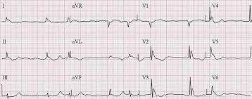 Image result for J Wave