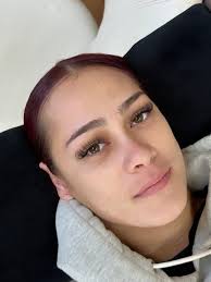 Has anyone lost an injured cat