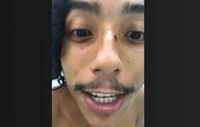 Após alegar legítima defesa, artista que confessou homicídio de fotógrafo é  solto