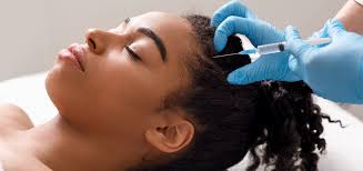 PRP for Hair Loss Washington DC