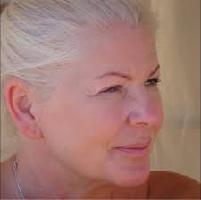 Hi, someone told me about a pigeon that was either attacked or hit by a car  yesterday early evening, I went and got him , kept him in a box in my