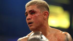 It reaffirms its commitment not to discriminate on the basis of race, color, age, religion, gender, national origin, sexual orientation or physical disability in its programs and activities. World Champion Jojo Diaz Will Headline Feb 13 Boxing Card In Indio