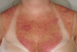 We did not find results for: Versteckte Hinweise Auf Der Haut Bildergalerie Zu Rheumatischen Erkrankungen