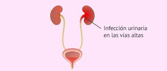 Infecciones Urinarias Causas Sintomas Y Tratamientos